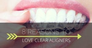 Closeup of a woman putting an Invisalign clear aligner on her teeth; clear aligners vs braces