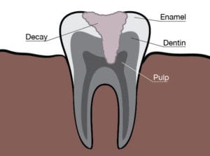 Redmond Family Dentist