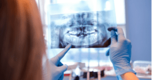 A dentist wearing blue gloves holds an x ray up to the light to examine their patient's results
