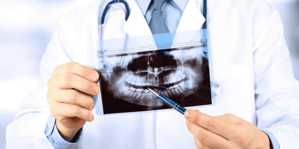 x rays used for dental diagnosis