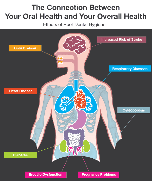 Info graphic of connections to oral health and overall health, and how gum disease can affect the rest of your body.