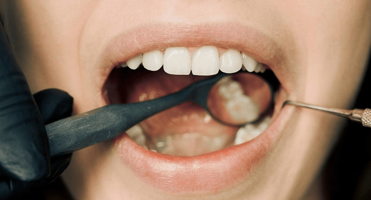 Tips for healthy teeth, and how to avoid gum disease